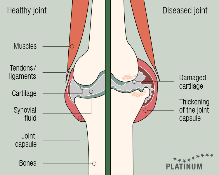 Comparison between a healthy and arthritic dog joint